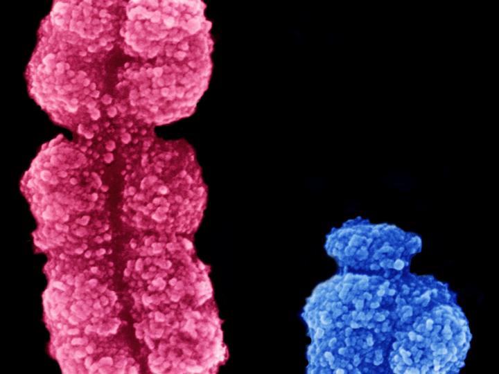 Communiquer les aneuploïdies des chromosomes sexuels détectées par NIPT