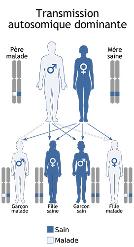 Trans-Autosomique-dominant