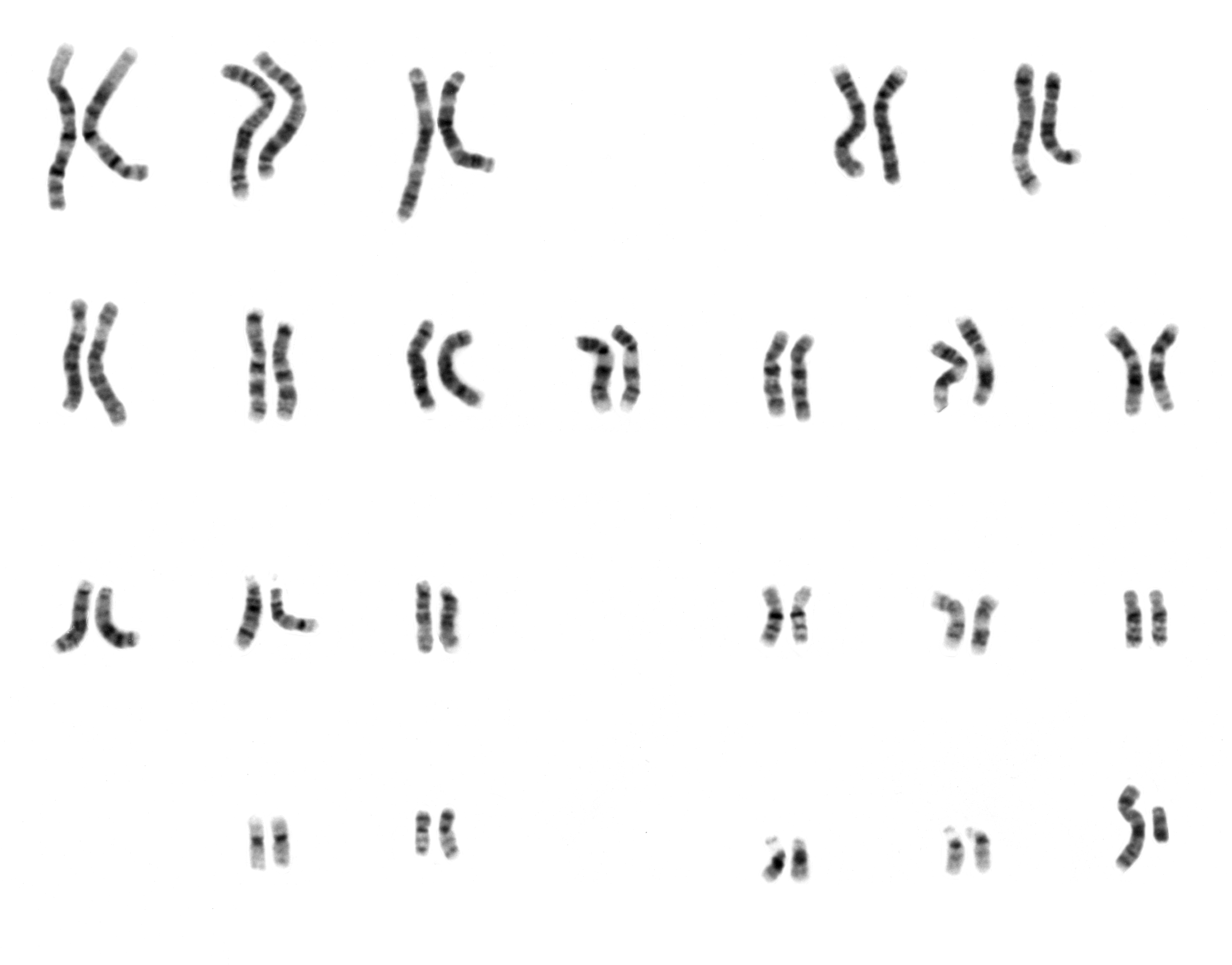 caryotype-humain-garcon